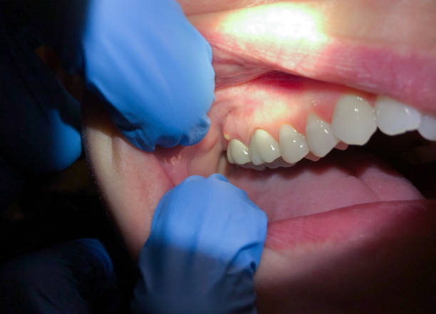 Best Dentist for Severe Toothache  in Forked River, NJ